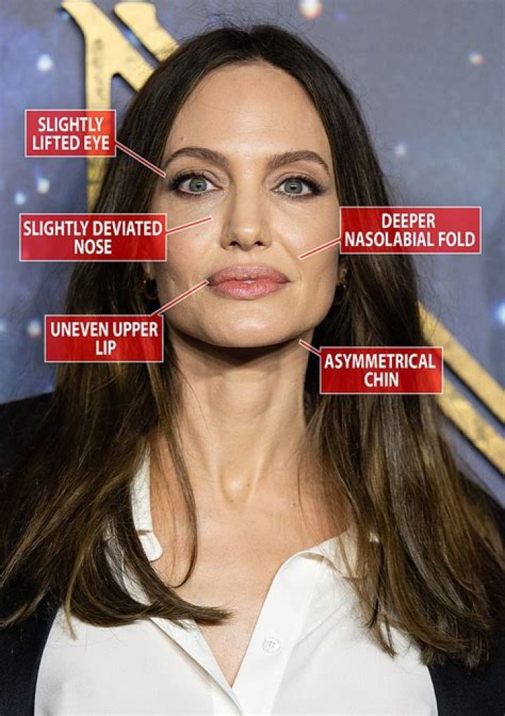Angelina Jolie Shares How Split From Brad Pitt Led to Facial Paralysis