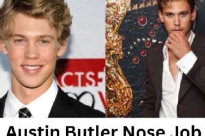 Austin Butler Has Done The Perfect Refined Nose Job