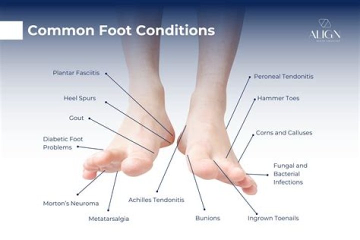 21 Foot Symptoms That Indicate Bigger Health Problems