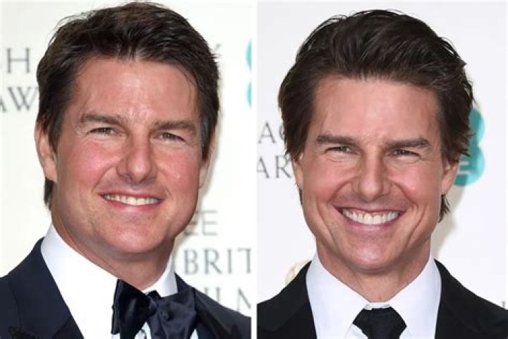 Has Tom Cruise Had Plastic Surgery?